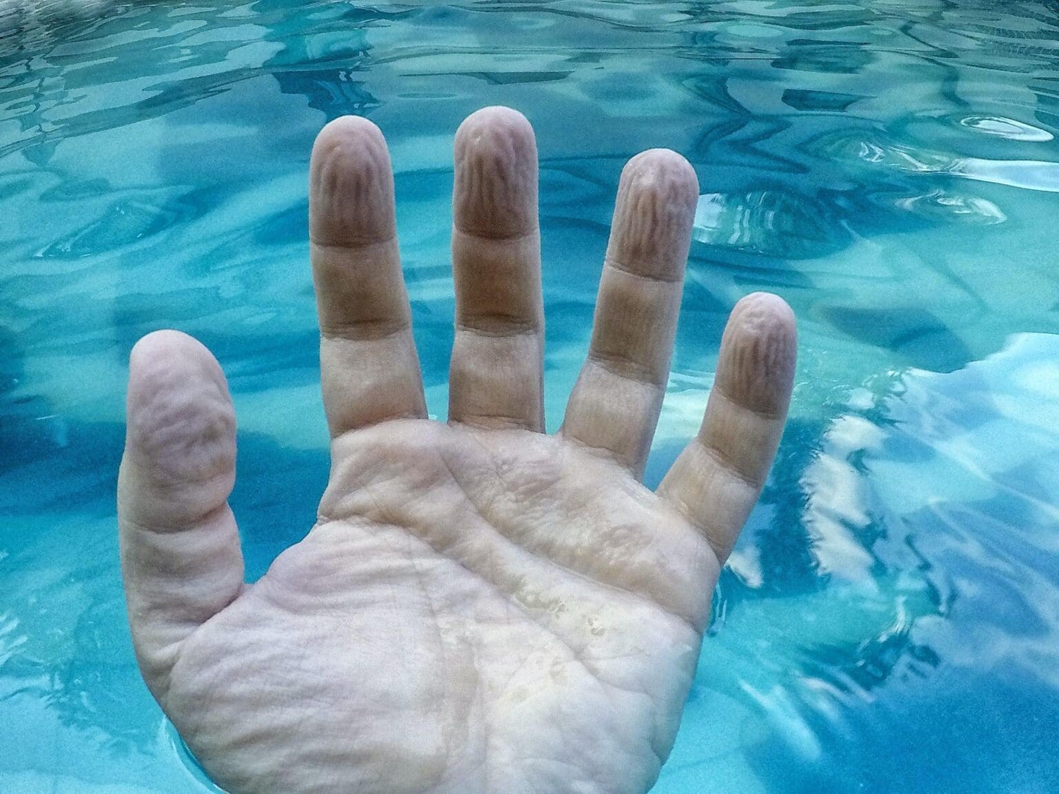 why-do-fingers-get-wrinkly-after-a-long-bath-or-swim-a-biomedical