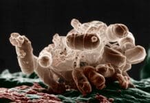 Antibiotics can trigger bacteria to release bubbles of inflammation tinder, making it harder to treat infection