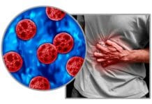 Cyclosporiasis sickens some people worse – why your diarrhea could be more explosive than others