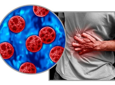 Cyclosporiasis sickens some people worse – why your diarrhea could be more explosive than others