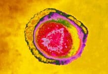 Shingles can cause severe chronic pain – new research on how exosomes alter neurons offers pathways to treatment