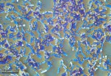 Hibernating bacteria can invade hospitals and survive outer space – but their high energy bill is a weakness that scientists can strike