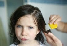 I’m a pediatrician and a mom – here’s how to treat lice without stigma